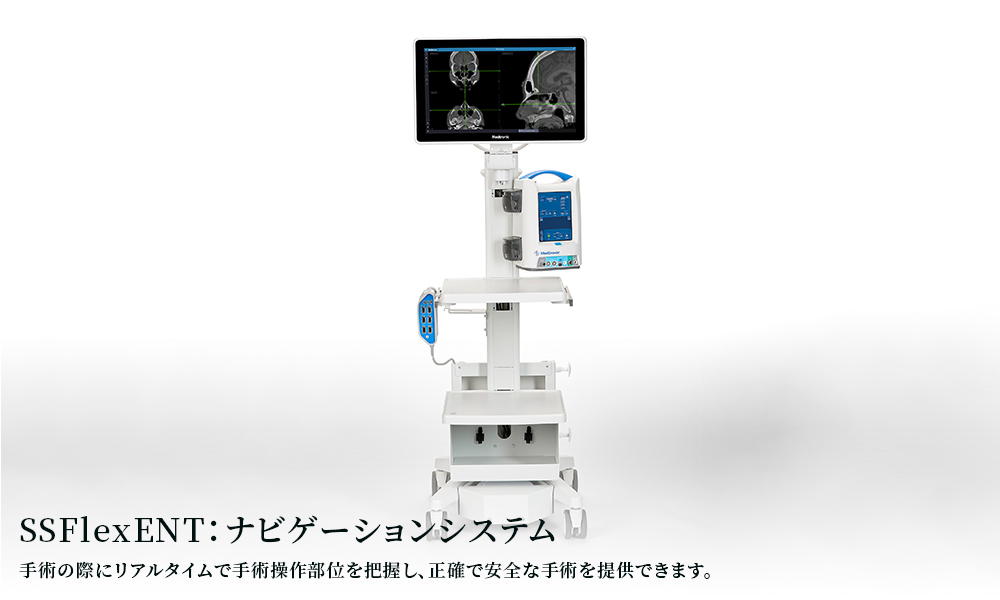 SSFlexENT：ナビゲーションシステム